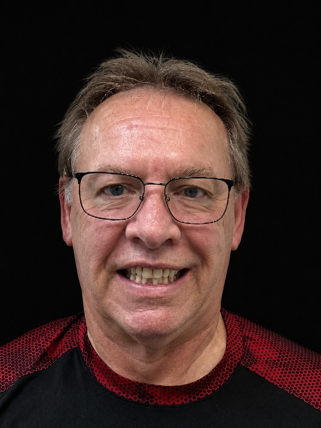 Steven smiling before Invisalign treatment