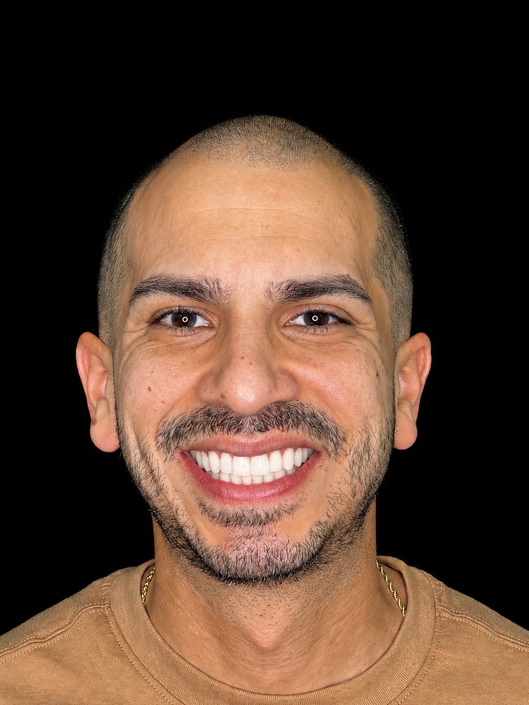 Wilfredo smiling after Invisalign treatment