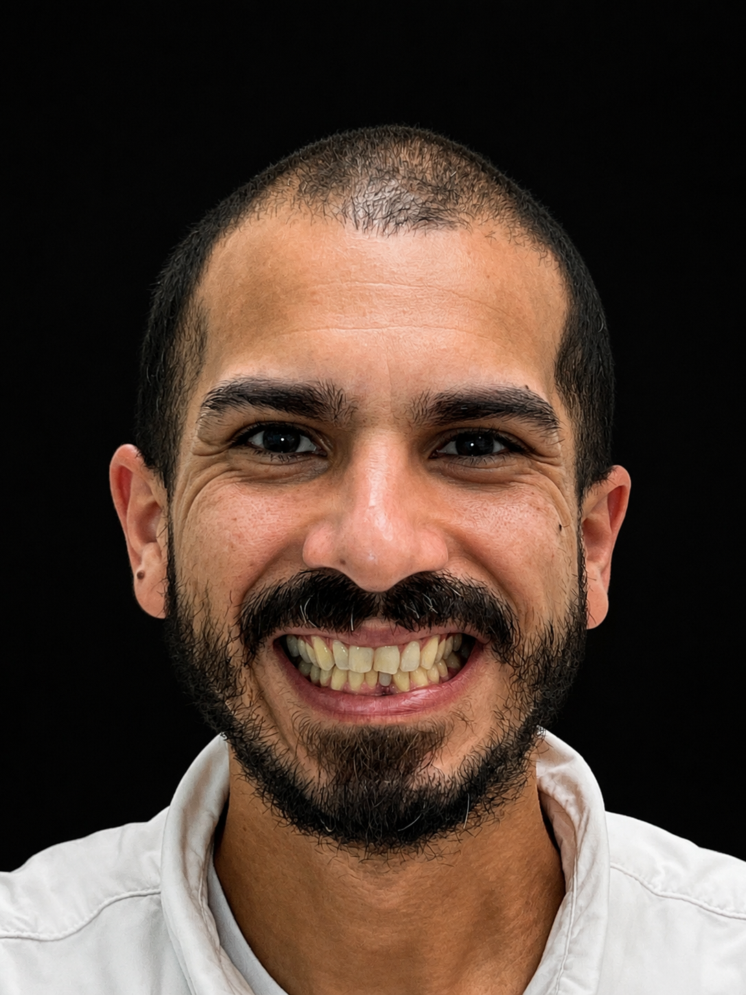 Wilfredo smiling before Invisalign treatment