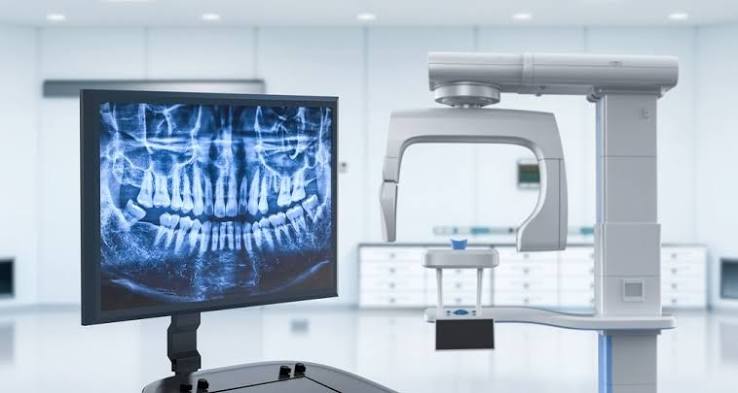 Digital panoramic X-ray machine with a full-mouth X-ray displayed on a monitor